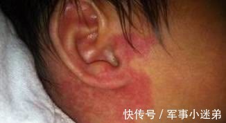 宝宝|若不想让宝宝留下胎记,孕期就别太任性,尽量不要有这4种行为