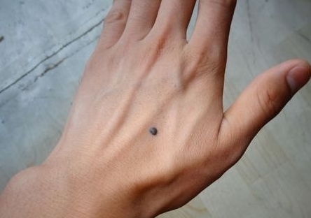 锯齿状|手掌有了“这个”,大多是“癌细胞”在向你招手,现在知道还不晚