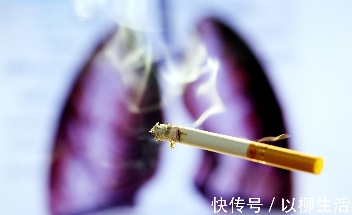 肺癌|晚期肺癌不能手术,还有这些方法可选择,可延长生命提高生活质量