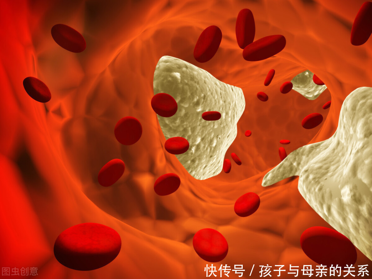 直言|53岁夫妇先后查出脑梗,失声痛哭!医生直言:这东西怎么天天吃