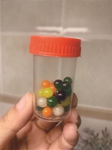 婴儿|婴儿误吞水宝宝 引发肠梗阻呕吐不止