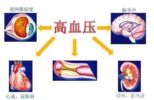 检查|高血压3年没治,就造成了心肾损害?发现高血压都该查些什么?
