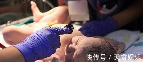 产妇|剖腹产时,若你赶上这个时间点,或许对产妇和宝宝都好!