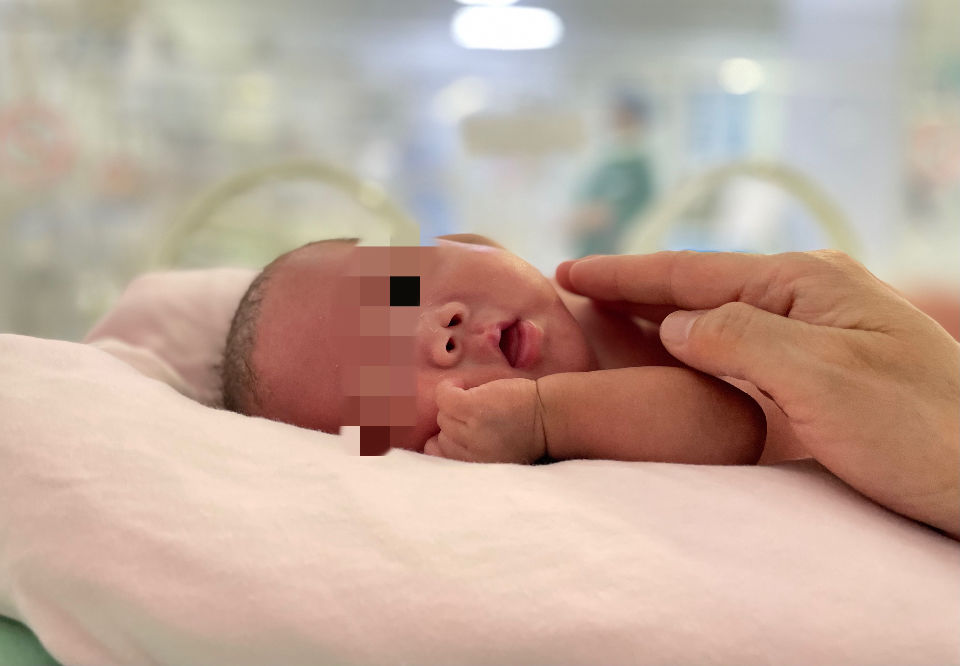 23+4周早产，体重450克，这位宝宝刷新山东存活新生儿记录