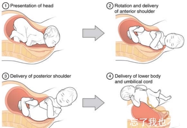 生产|为何动物的生产那么轻松，而人类分娩却疼得撕心裂肺？