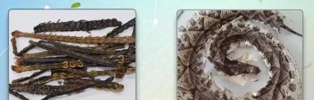 先兆|牢記中風9大先兆，識別中風只需10秒！1個妙招，遠離中風