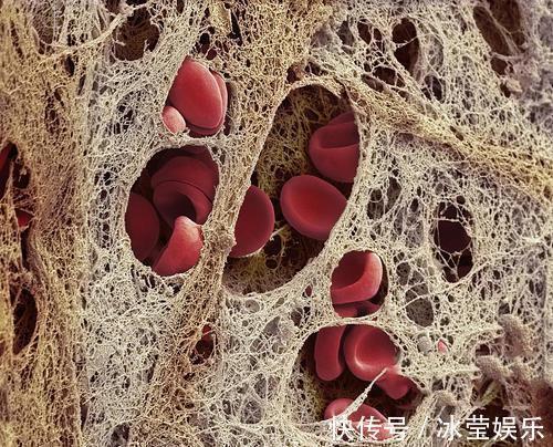 血管|3种调味剂,比糖和盐更“伤身”你或许经常吃,怪不得血管会堵