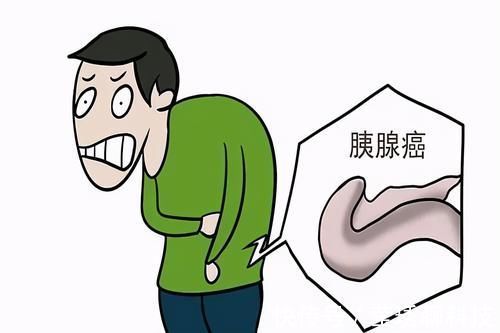 生存率|胰腺癌生存率低,不易被发现,提醒:早期的3个症状,你没当回事