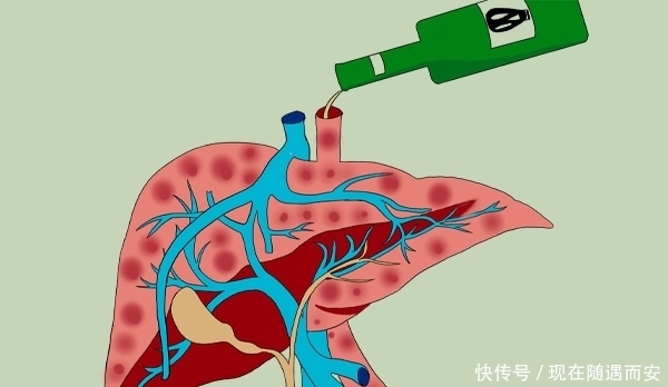 到底|白酒、红酒和啤酒,到底哪种才是伤肝“冠军”?答案其实很明显
