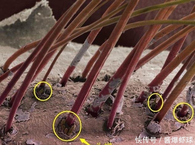 提醒:头上有螨虫的人,可能会有4种表现,别忽视了!