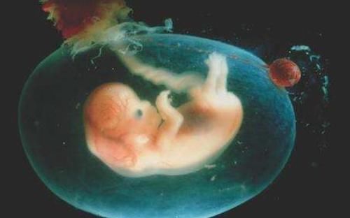 宝妈|孩子出生自带“金钟罩”,护士连连道喜,产妇:我生了个哪吒?