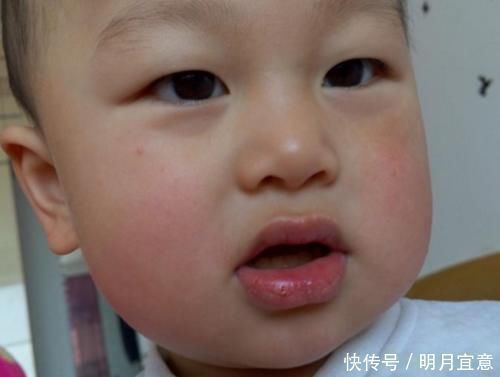 孩子|儿科医生提醒:孩子积食脾虚,身体会有3处异常,家长应尽早重视