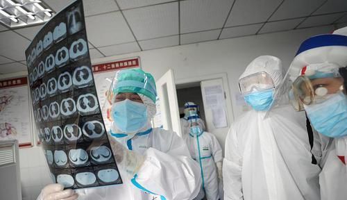  过程中|体检查出肺部有阴影，多有4种可能，别胡思乱想