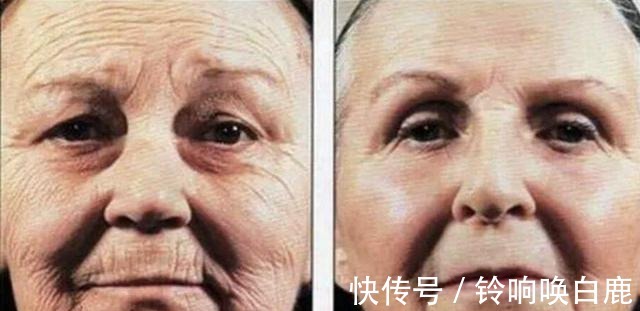 f50|“坚持防晒”和“从不防晒”的女生,几年后皮肤会有什么变化