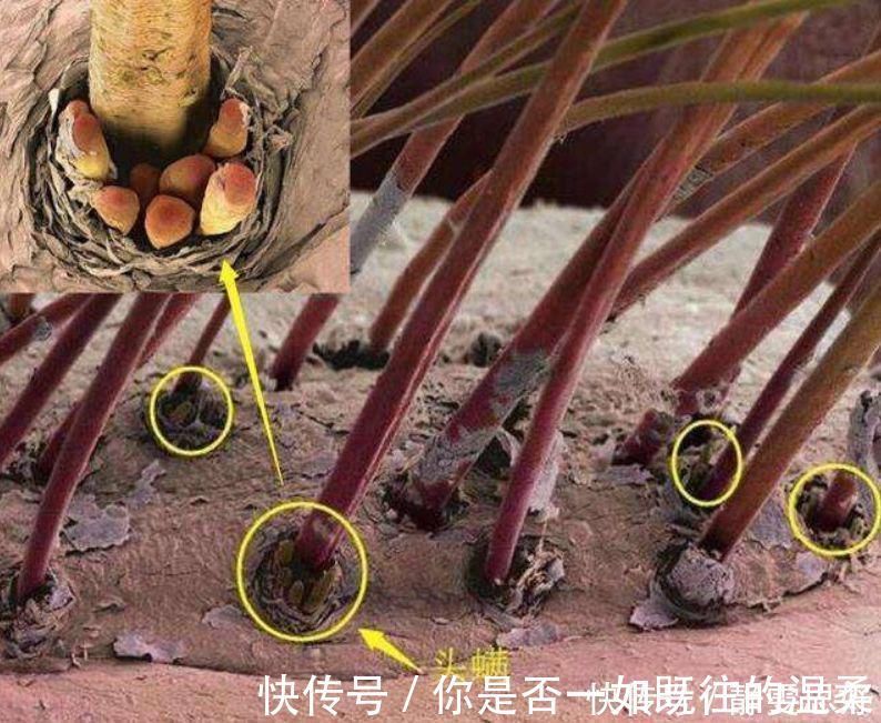 发质|不想让头发变“大油田”?洗头时戒掉这3习惯,发质或会“越来越好”