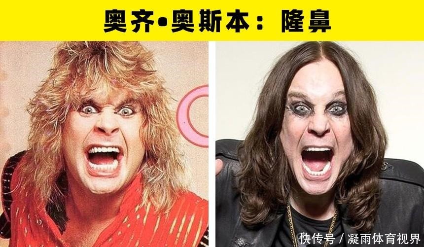 乔治·克鲁尼|大方承认自己做过整形手术的8名好莱坞明星