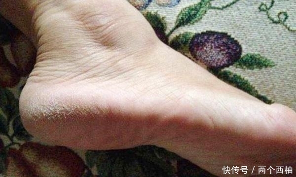  不好|肝脏不好的人，平时少吃这3种白色食物，肝脏会“感谢”你