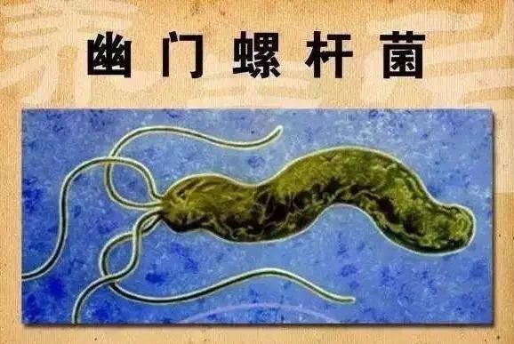 幽门螺旋杆菌感染|实锤！幽门螺杆菌是“明确致癌物”，怎么防？