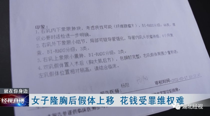 肩膀|女子隆胸后假体移位:“胸长到肩膀下面了”