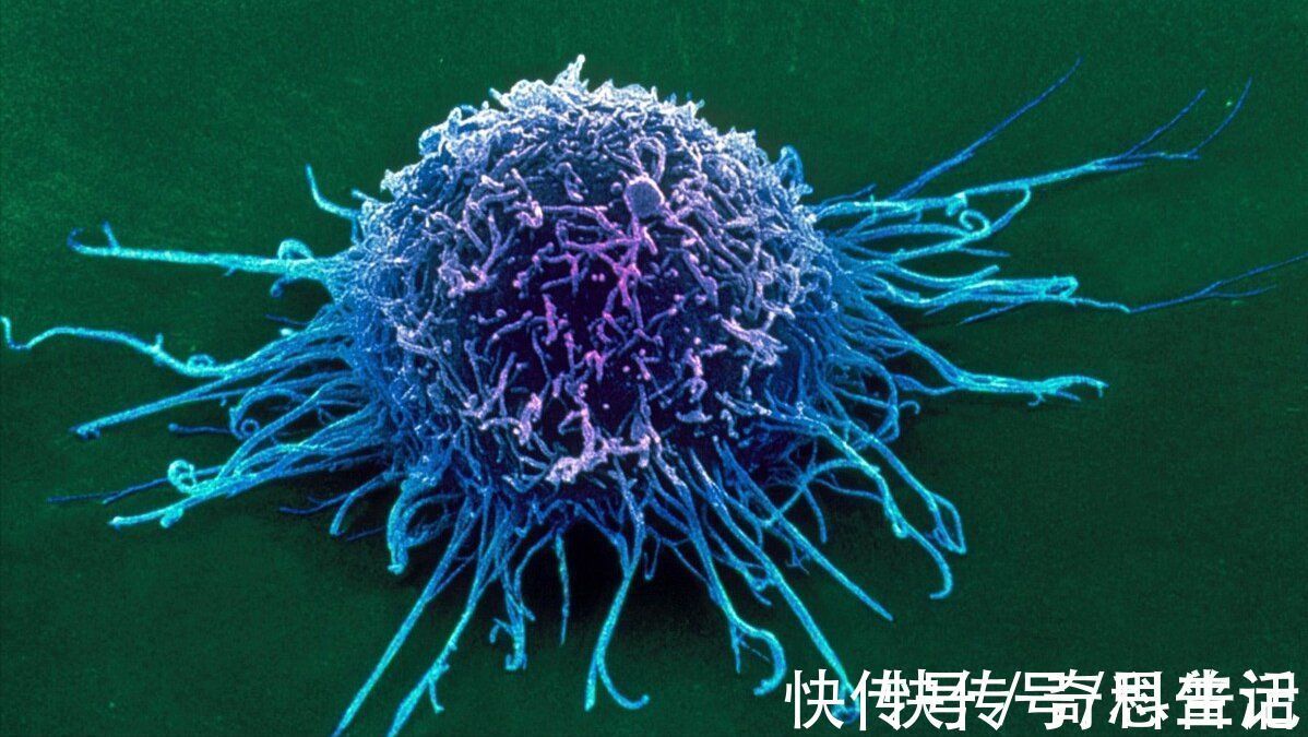 细胞|癌细胞为什么这么顽固?假如吃下一块癌细胞,人体会发生什么?