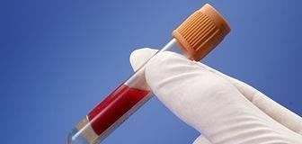 血脂|民间说“无鳞鱼勾旧病”，有道理吗？告诉你高血脂病人，如何吃鱼