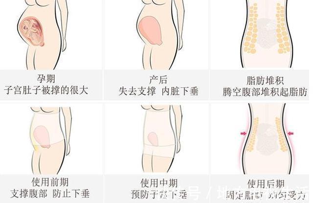 tips|产后什么时候可以穿收腹衣剖宫产和顺产的时间有不同，别记错了