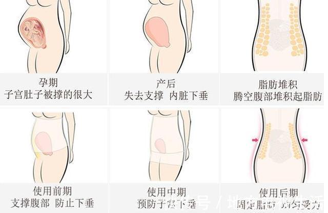 tips|产后什么时候可以穿收腹衣剖宫产和顺产的时间有不同,别记错了
