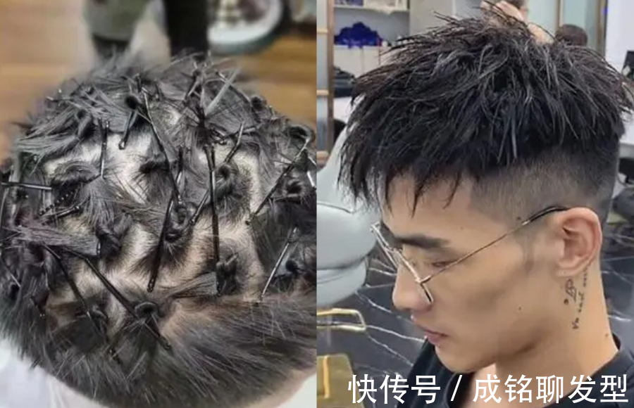 发质|烫锡纸烫后掉发严重,会变成秃顶吗?看这三点就明白掉发的原因了