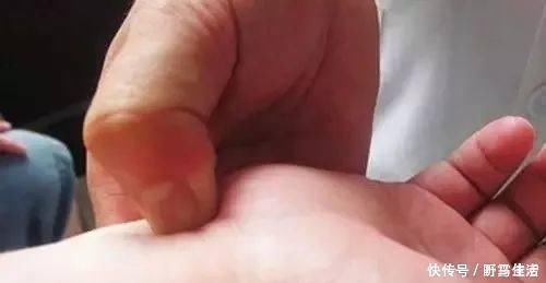 神门穴|按摩手腕上这个穴位,能调理十大疾病几秒钟学会,一按就灵