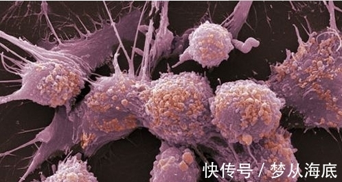 放疗|癌症患者在术后,为什么还要放化疗呢?或许有的治疗过度了