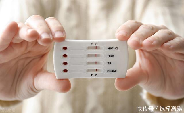 “高危”性行为后多久能排除性病医生依据症状和检查来排除