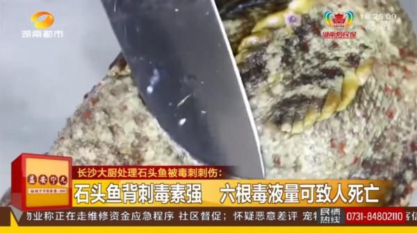 长沙|被鱼刺扎一下，长沙男子紧急送医！医生：这种鱼刺6根可致死！