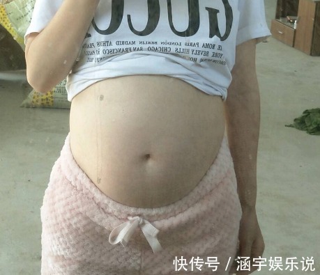 宝妈|怀孕八个月查出畸形,忍痛引产看到孩子后,整个房间都安静了