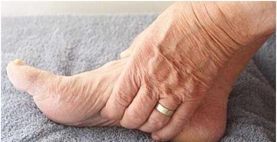 芦笋液|身上这3处发麻,多是脑梗塞的前兆,麻痹大意者,当心脑梗来袭