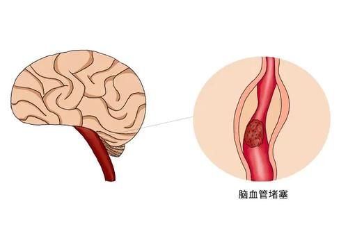 连表情包都戒烟了，你还有理由不戒烟吗？吸烟的危害早知晓