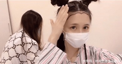 毛囊|蔡萝莉发际线上移,为了美丽植发11个小时,一个毛囊报价12元!