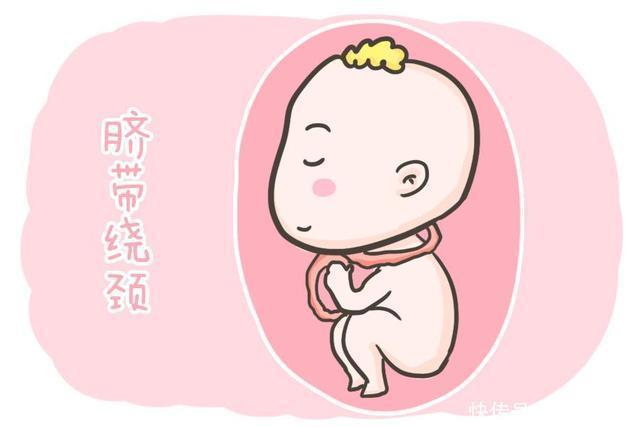 怀孕期间|胎宝“脐带绕颈”，并不是准妈妈常摸肚子造成的，别再勿信谣言了