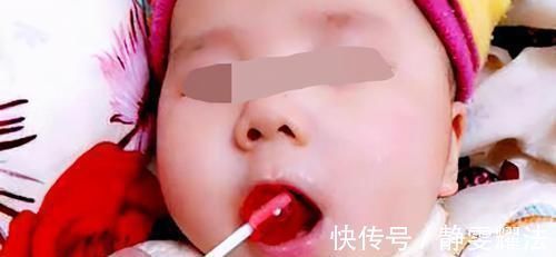 消化器官|五个月女婴双肾长满结石,只因刚出生三天,父母就开始做这件事