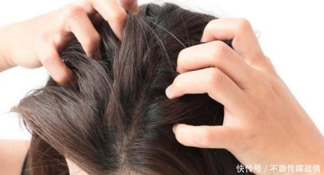 头皮健康关乎头发健康,而这些行为会损伤头皮!
