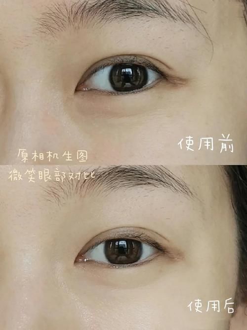 实话，“眼霜”这几款够了，口碑好还不贵，每一款都很好用