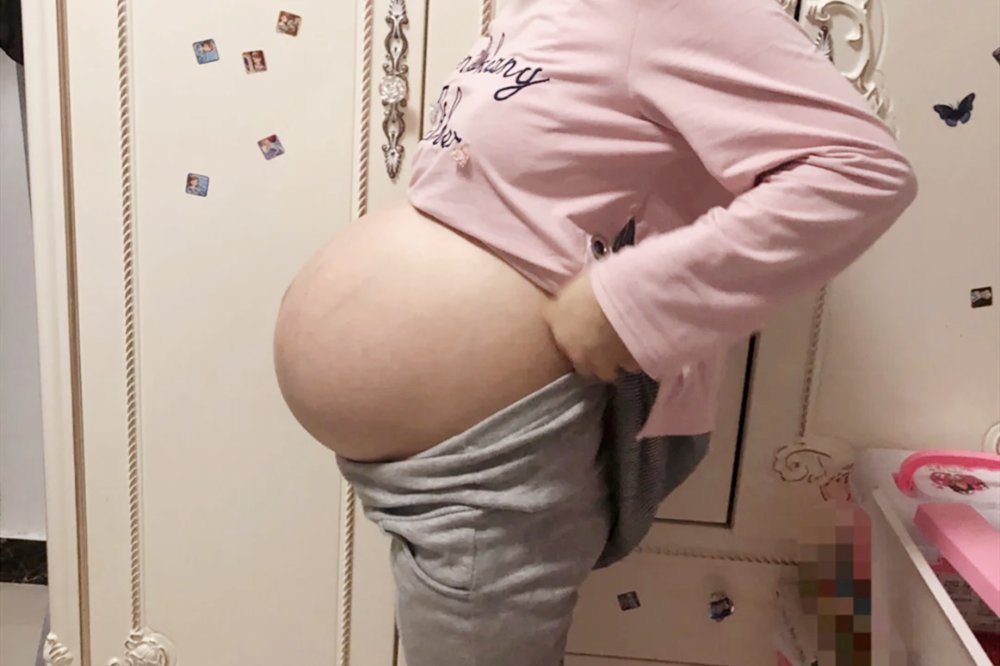 孕肚|“悬浮肚”多十产九剖，想要顺产过关有讲究，孕妈最好别强求