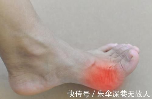 痛风患者|尿酸高5类食物要忌口，会让尿酸越来越高，痛风“缠上”你！