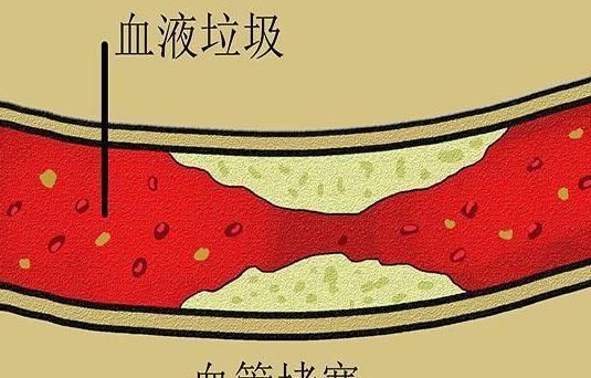 心脑血管|过了50岁之后如果还没得过这些病,或许活到百岁高龄不是梦