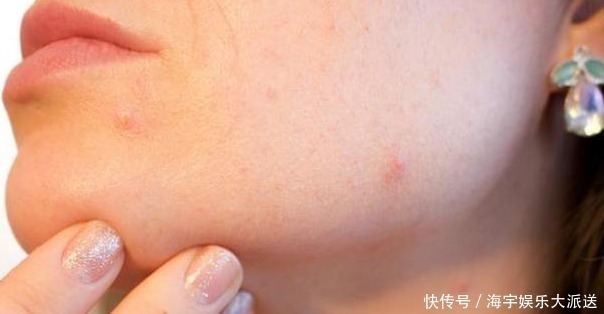 肝损伤|“肝毒”太深，“脸上”有3种表现，排除肝毒，按一穴、吃三蔬