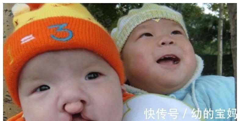 胎儿|孕期胎儿频繁好动,孕妈以为孩子很健康,产检后医生建议不能留