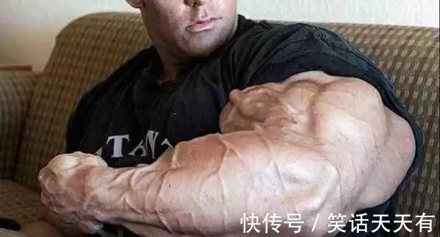 冠军|26岁健美冠军,小腿突发意外,体脂太低是“原罪”