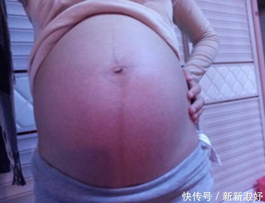 怀孕之后肚子上浮现一条“黑线”，妈妈嫌丑婆婆嫌细，别再迷信了