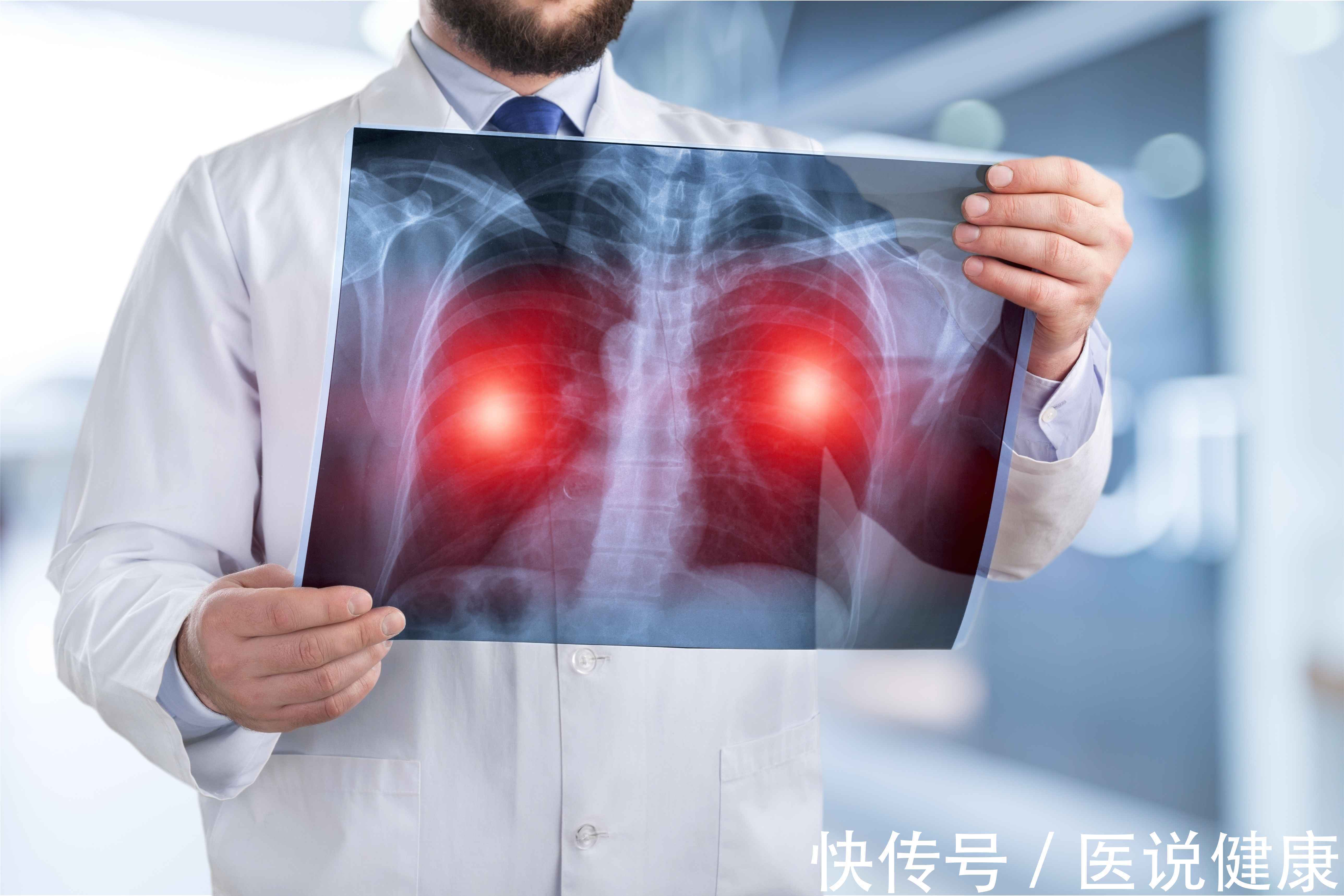 肺部|身体出现这4种情况，要引起重视，肺部或已发生病变，趁早检查