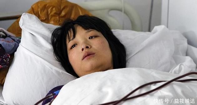 伤害|“尿毒症”多是吃出来的,3种食物早忌口,肾可能会“感激”你