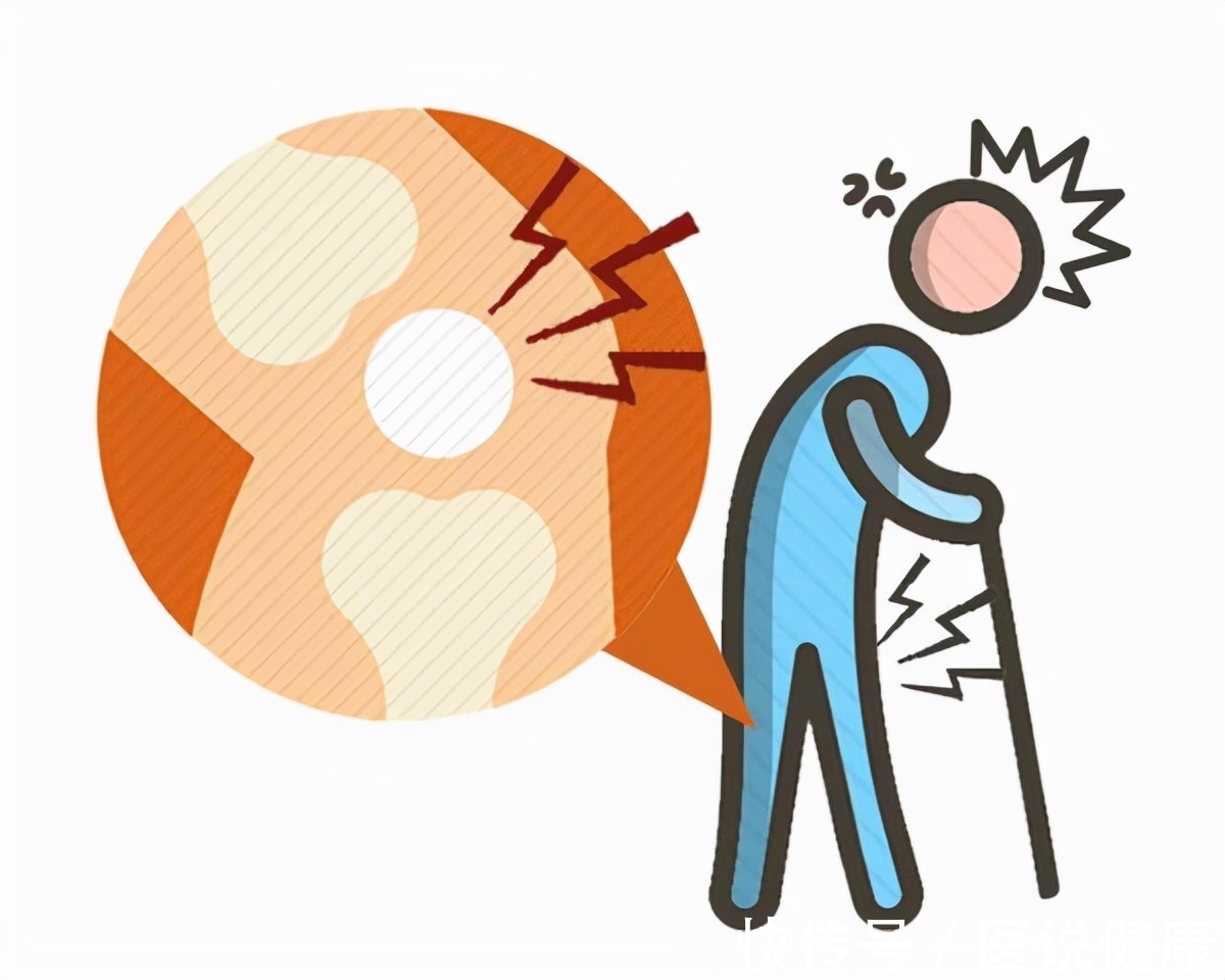 关节|立冬将至,痛风来袭?秋末冬初,不想被痛风“折磨”,做好5件事